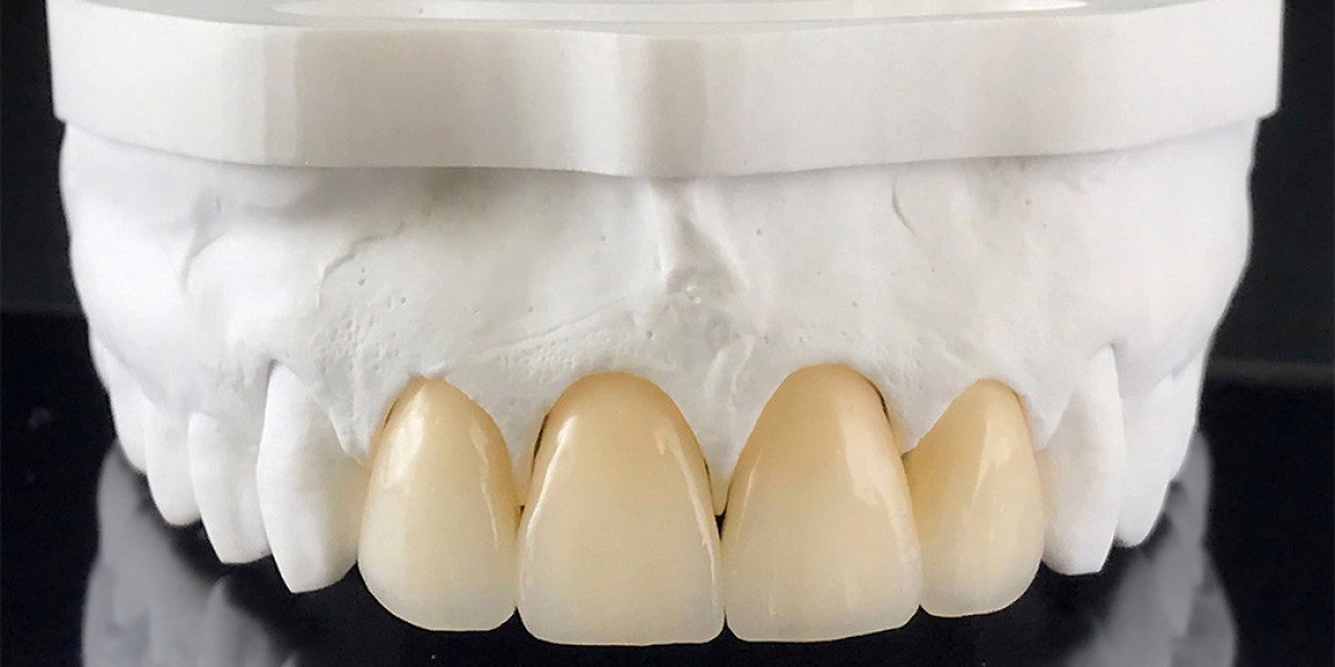 Zirconia Crown Dubai for Durable, Aesthetic Results