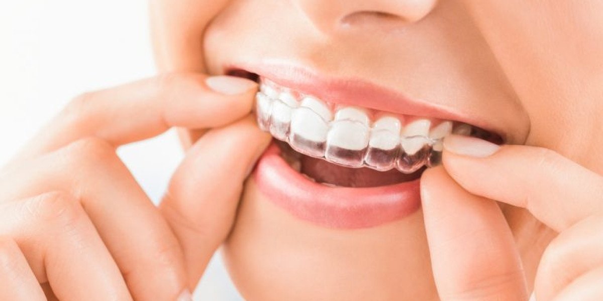 Invisalign Braces Dubai for Clear Teeth Straightening
