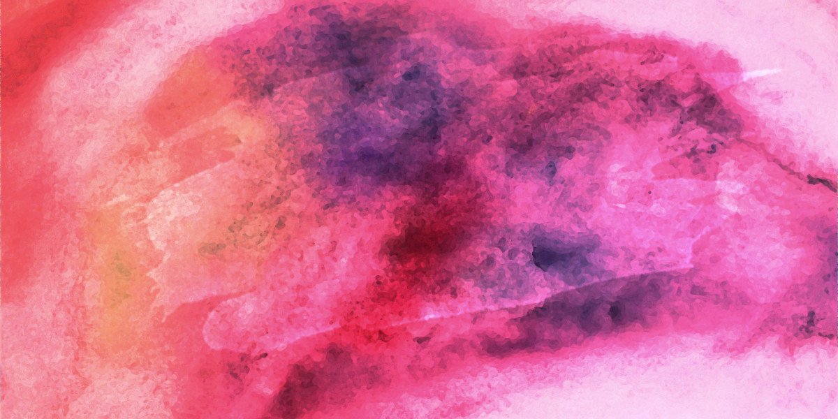 Understanding Capital Gold IRA: A Comprehensive Guide