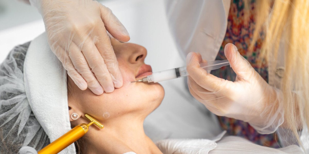 How Sculptra Fillers in Dubai Restore Volume and Youthfulness