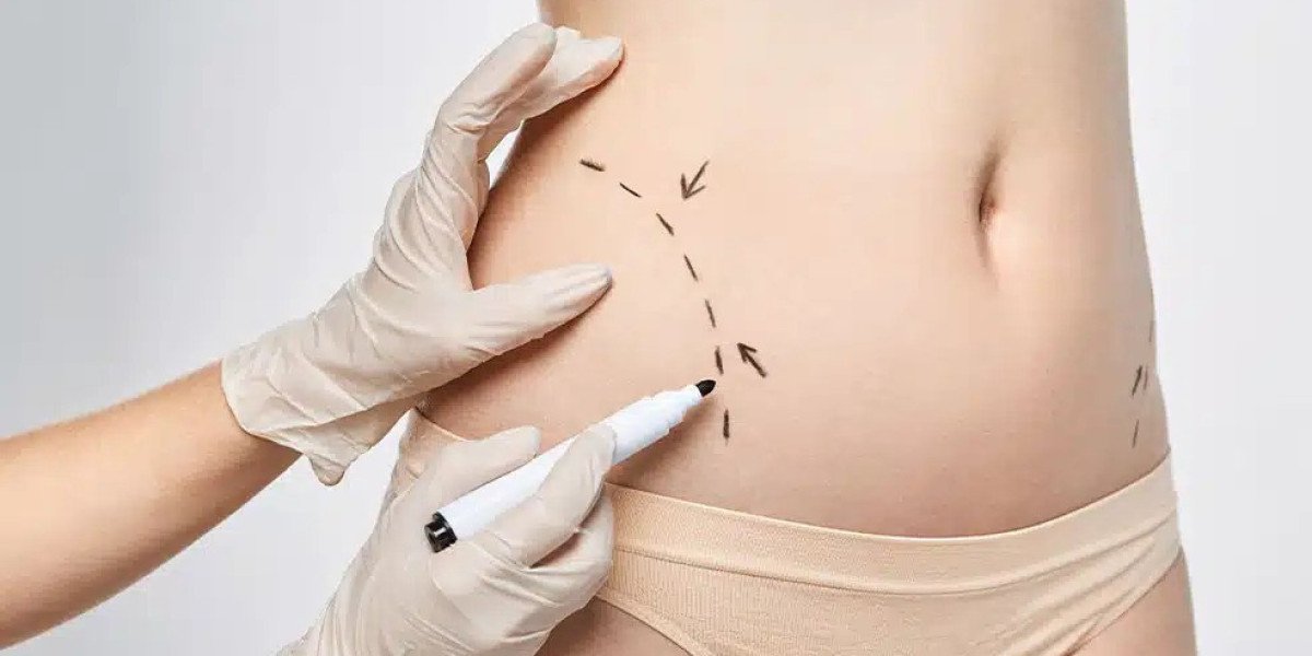 Body Contouring in Dubai for Post-Weight Loss Patients