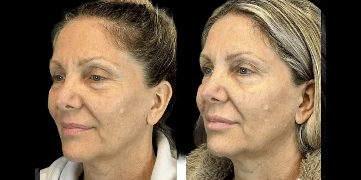Latest Beauty Trends You Can Try at the Best Aesthetic Clinic in Dubai