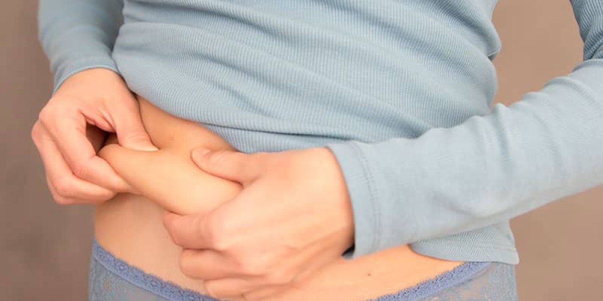 Discover Perfect Result with Best Liposuction Surgeon in Dubai