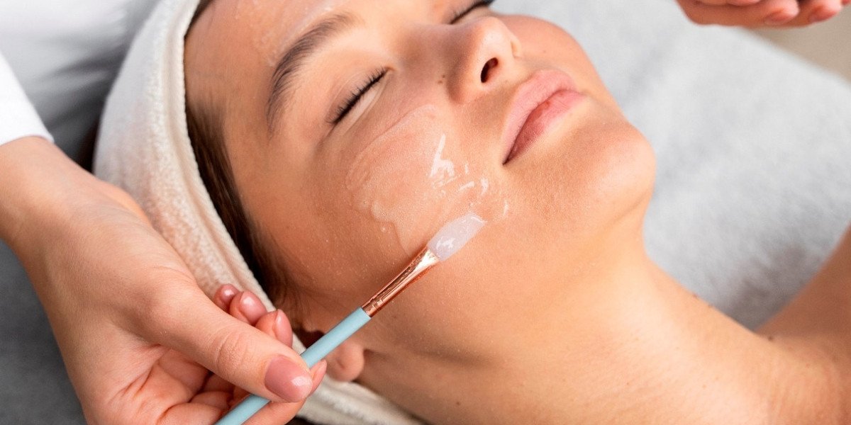 Chemical Peels in Islamabad: A Beginner’s Guide